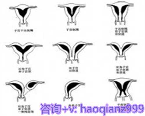 四川正规助孕价格,让您实现做父母的梦想