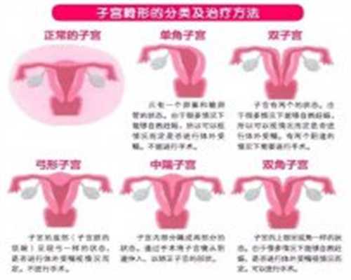 重庆私人爱心助孕,不孕不育21步筛查法的意义