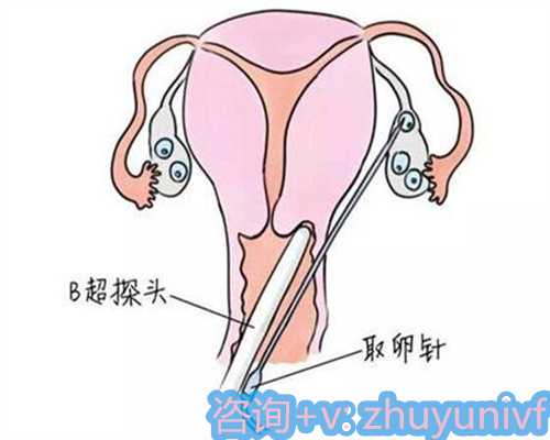 青岛正规供卵试管医院,精子库要排队吗